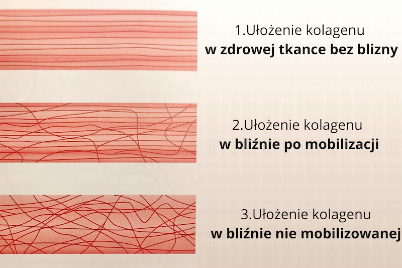 ułożenie kolagenu w bliźnie mobilizowanej i niemobilizowanej